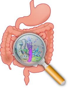 Irritable Bowel Syndrome (IBS): Symptoms, Causes, Diagnosis, and Treatment