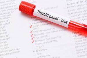 Thyroid Profile